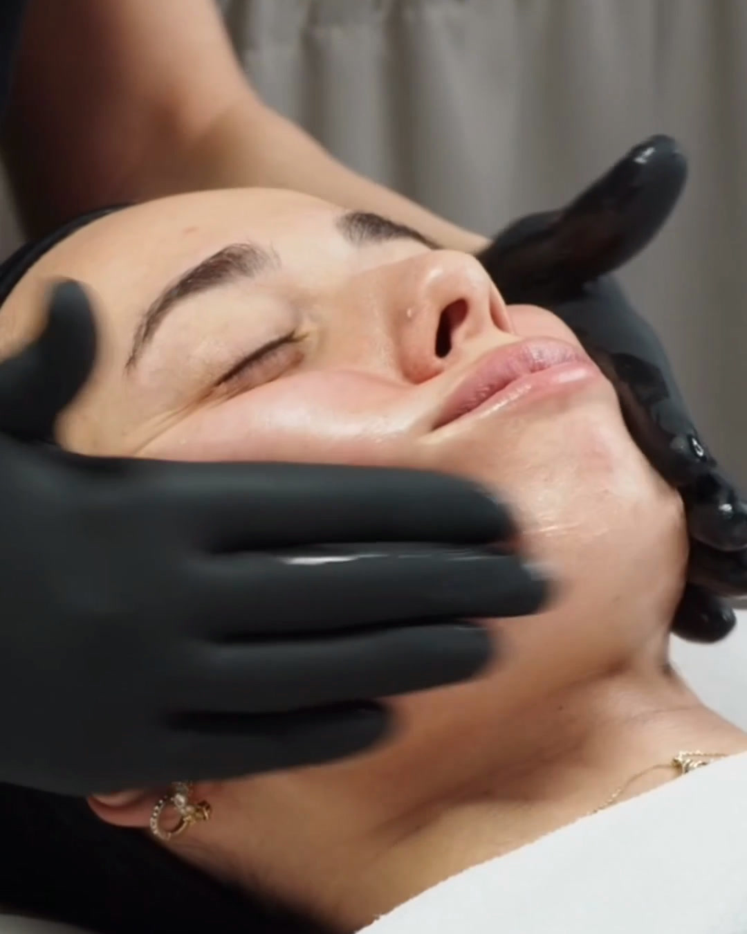 A peel solution being spread over the skin with gloved hands